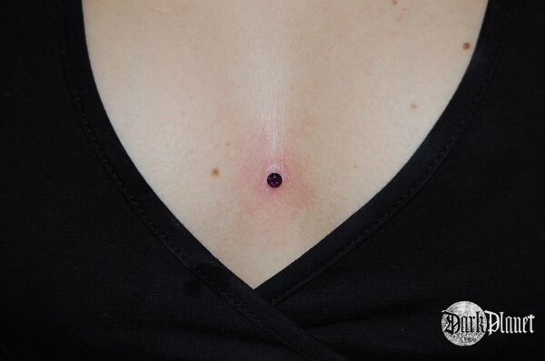 microdermal mostek