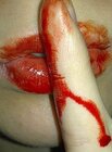 morfina